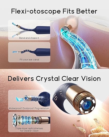 Ear Cleaner Tool Kit, Reusable Ear Wax Removal Tweezers Cleaning with Flexible 1080p Camera Wireless with WiFi - Image 2