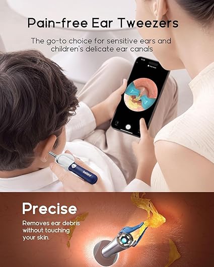 Ear Cleaner Tool Kit, Reusable Ear Wax Removal Tweezers Cleaning with Flexible 1080p Camera Wireless with WiFi - Image 8