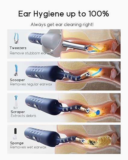 Ear Cleaner Tool Kit, Reusable Ear Wax Removal Tweezers Cleaning with Flexible 1080p Camera Wireless with WiFi - Image 9